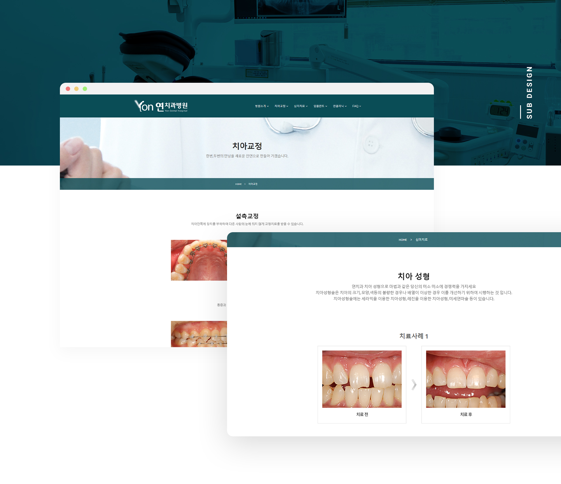 con02.jpg 연치과병원 치과홈페이지제작